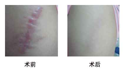 ������̺�Ч���DƬ