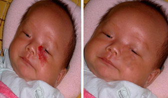 ȥѪ����Ч����Ƭ