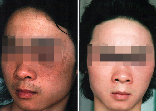 ȥɫ����Ч������