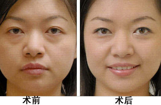 ��Ę���޵�Ч���D