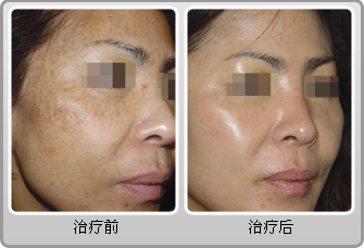 �����L(f��ng)���ί�Ч��