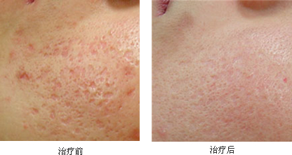 ���������ӡЧ��