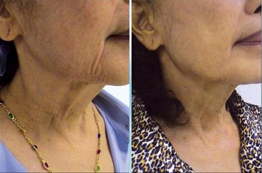 ���l����Ч�����Ȱ���