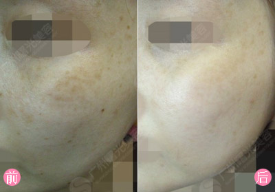 ̼���x������Ч������