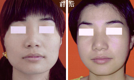 �沿�������������Ա�ͼƬ