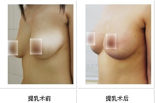 �鷿�´���������Ч���Ա�ͼ