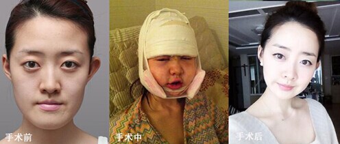 �����������沿������������