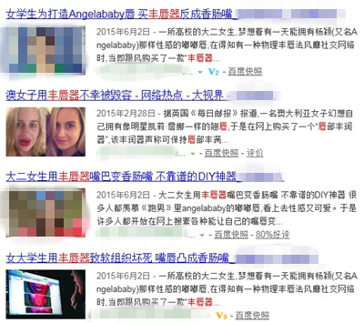 丰唇器