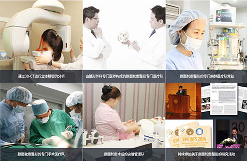 上海华美改脸型