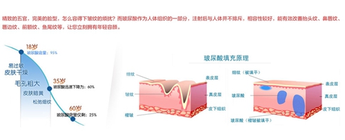 微整形玻尿酸