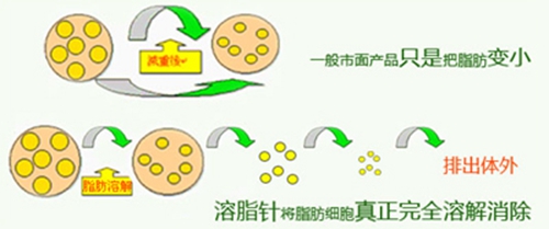 杭州时光整形瘦脸