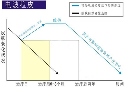 电波拉皮