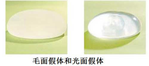 毛面光面假体