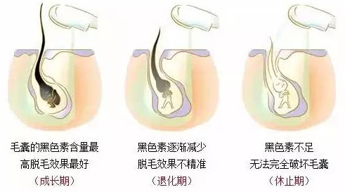 毛发生长周期