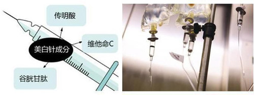 美白