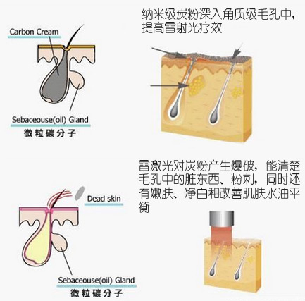 黑脸娃娃原理