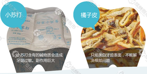 美白牙齿方法2