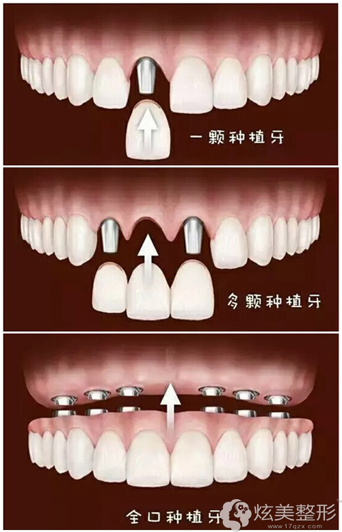 ���ݻ���22���������������Ż� ��������3800Ԫ