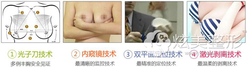 �人����¡�ؼ�������