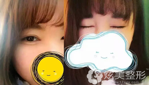 �ŷ�ҽ��˫��Ƥ����20�쿴�����ۼ�����Ȼ