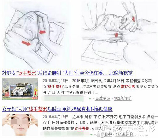 徒手整形不靠谱,失败案例 徒手整形不靠谱,失败案例