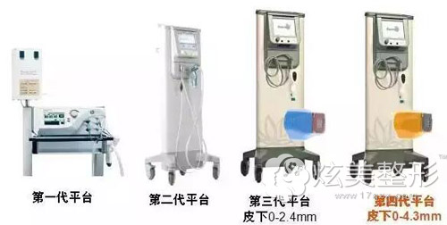 热玛吉仪器四代进化历程 热玛吉仪器四代进化历程