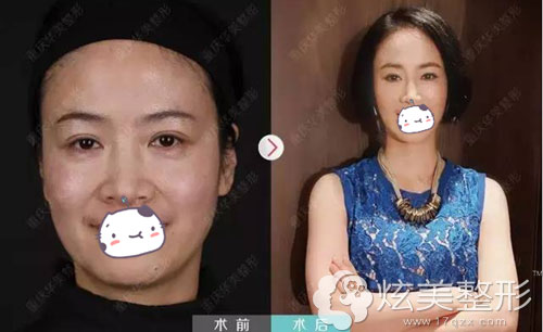 �ߵ�ɹ���ʵ�������컪������