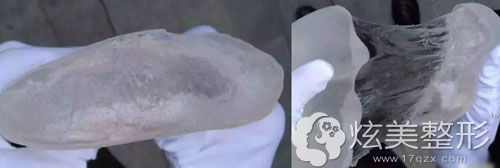 �п���ġ���ǉ��¡�ؼ��岻������ճ�Ժ�