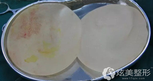 假体隆胸用的硅胶 假体隆胸用的硅胶