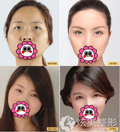 �����ɱ䰸��ͼ�����������ҽԺ