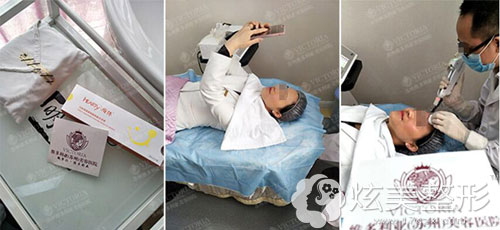 嗨体除皱案例过程 嗨体除皱案例过程