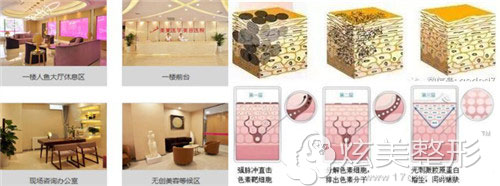 石家庄美莱整形环境图激光祛雀斑示意图 石家庄美莱整形环境图激光祛雀斑示意图