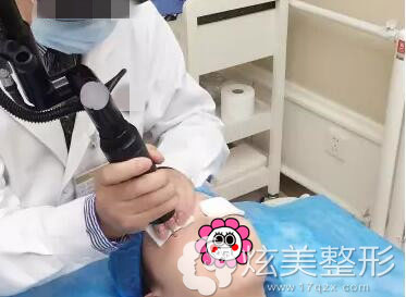 激光祛黑眼圈案例过程图上海玫瑰整形医院 激光祛黑眼圈案例过程图上海玫瑰整形医院