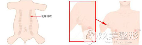 副乳是怎么形成的 副乳是怎么形成的