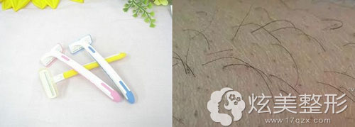 刮毛简便但新长出的毛发又粗又硬 刮毛简便但新长出的毛发又粗又硬