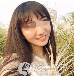 武汉中爱整形真人案例祛痘效果图 武汉中爱整形真人案例祛痘效果图