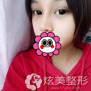 ���ۺ�����һ����Ч��ͼ������������