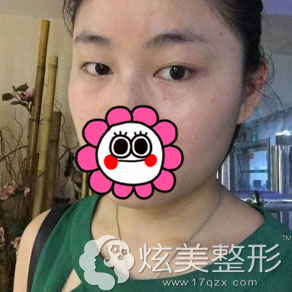 ���ݰ���������˫��Ƥ������ǰ��