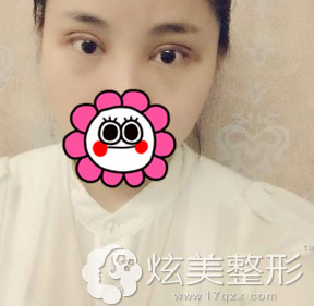 ���ݰ�����˫��Ƥ��ʵ��������ָ�Ч��