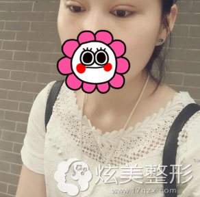 ���˰���˫��Ƥ�������Ч��