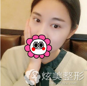���ݰ���������˫��Ƥ���˰���3����Ч��ͼ