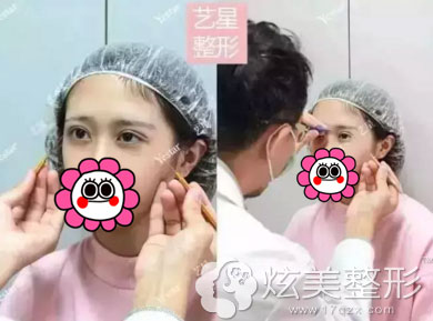 都志杰医生对眼部情况进行查看 都志杰医生对眼部情况进行查看