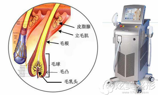 使用冰点脱毛仪器的九江华美整形 使用冰点脱毛仪器的九江华美整形