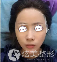 �ո������о�Ƥ����������