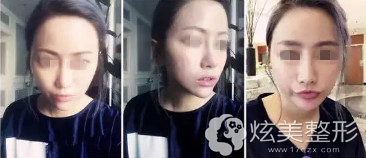 14��������沿�仯