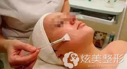 果酸祛痘过程图 果酸祛痘过程图