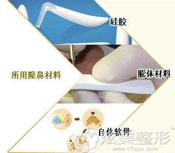 厦门海峡采用自体组织和仿生假体 厦门海峡采用自体组织和仿生假体