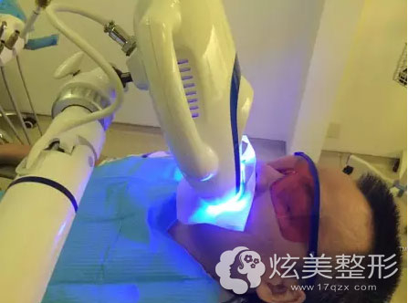 广州和睦家冷白美白牙齿过程 广州和睦家冷白美白牙齿过程