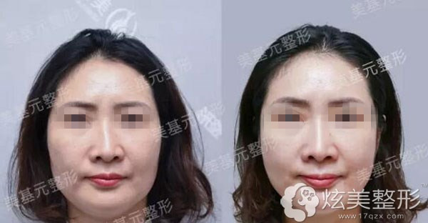 ��ǽ��������人����Ԫ����ǿԺ��