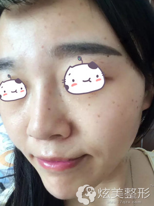 ���꼤����������ʼ���������ָ�
